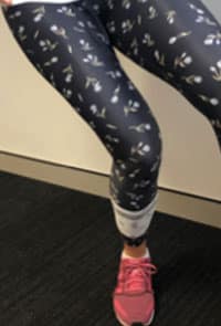 Poor Single Leg Squat Technique