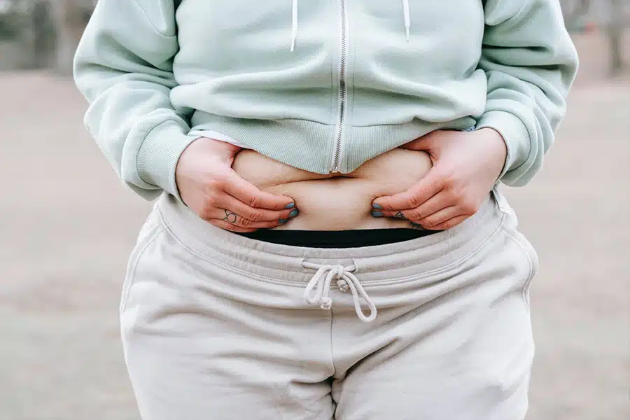 Signs You May Have Abdominal Muscle Separation